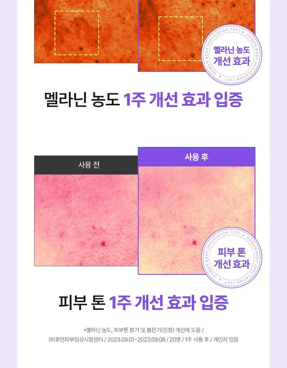 [잡티미백케어] 성분에디터 머루포도 비타 C 잡티크림 50g 상세페이지 11